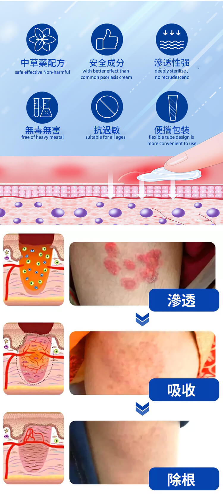 曼秀雷敦ad止癢消炎乳膏1780999782272163.jpg 曼秀雷敦ad止癢消炎乳膏