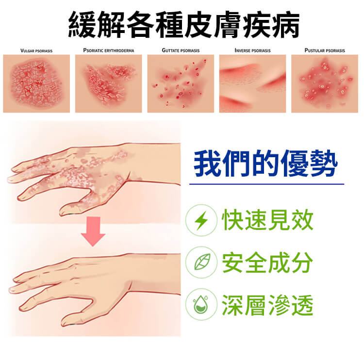 曼秀雷敦ad止癢消炎乳膏1780999782338298.jpg 曼秀雷敦ad止癢消炎乳膏