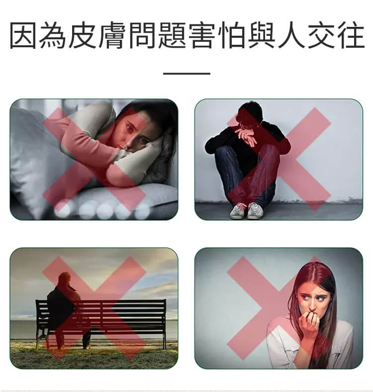 曼秀雷敦ad止癢消炎乳膏1780999782649724.jpg 曼秀雷敦ad止癢消炎乳膏
