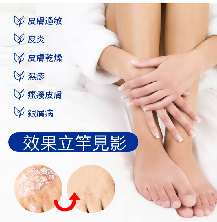曼秀雷敦ad止癢消炎乳膏1780999782684372.jpg 曼秀雷敦ad止癢消炎乳膏