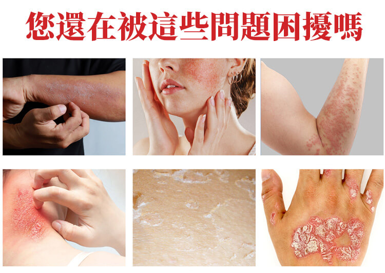 曼秀雷敦ad止癢消炎乳膏1780999782702611.jpg 曼秀雷敦ad止癢消炎乳膏