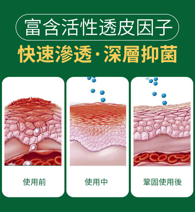 曼秀雷敦ad止癢消炎乳膏1780999782769965.jpg 曼秀雷敦ad止癢消炎乳膏