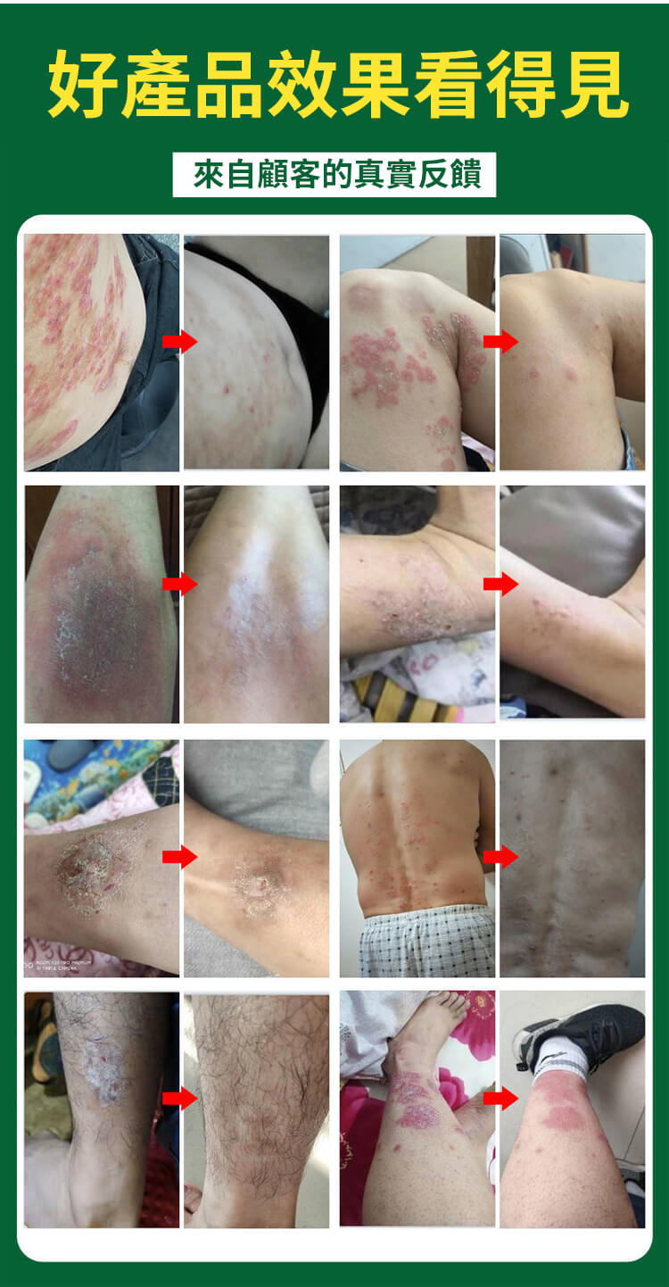 曼秀雷敦ad止癢消炎乳膏1780999783998054.jpg 曼秀雷敦ad止癢消炎乳膏